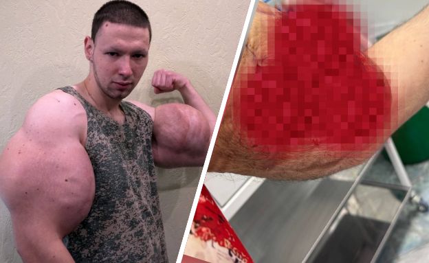 קיריל טרשין