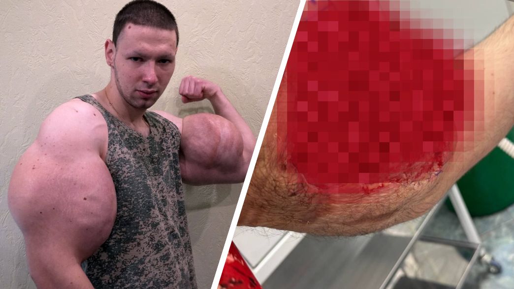 קיריל טרשין קיריל טרשין