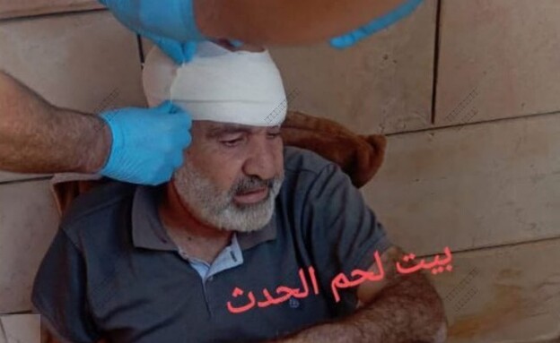 ערבים מדווחים על מספר פצועים בכפר ח'לת א-נחלה