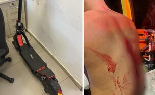 נערים תקפו שליח (צילום: דוברות המשטרה)