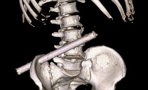 נובוצ'בוקסארסק (צילום: מתוך הרשתות החברתיות לפי סעיף 27א׳ לחוק זכויות יוצרים)