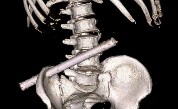 נובוצ'בוקסארסק (צילום: מתוך הרשתות החברתיות לפי סעיף 27א׳ לחוק זכויות יוצרים)