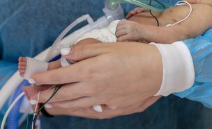 פגה 420  (צילום: ענבל רשף)