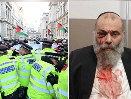 האנטישמיות באירופה הולכת וגדלה: "המספרים הרבה יותר גבוהים ממה שחשבנו"