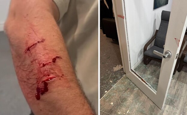 חייל צה"ל שנפצע בטורונטו