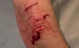 חייל צה"ל שנפצע בטורונטו (צילום: Students Supporting Israel)