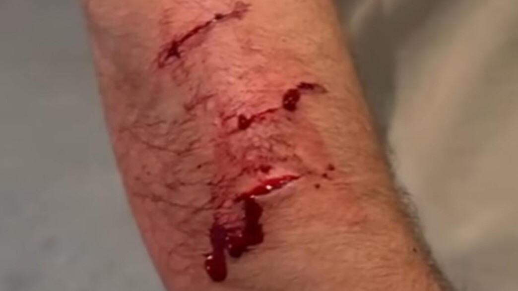 חייל צה"ל שנפצע בטורונטו