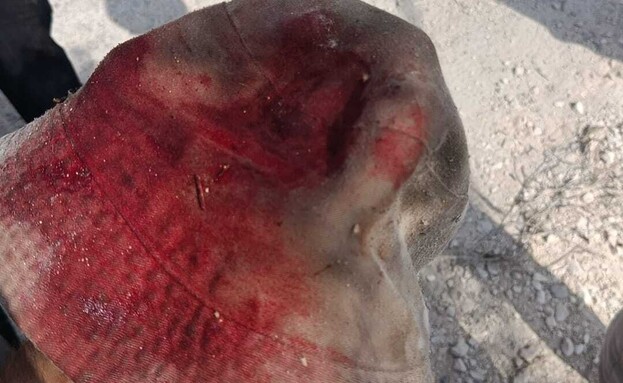 יובל בן ארי, הותקף במסיק זיתים יובל בן ארי, הותקף במסיק זיתים