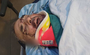 עודד ידעיה, נפצע באירוע אלימות במסיק בבורין 