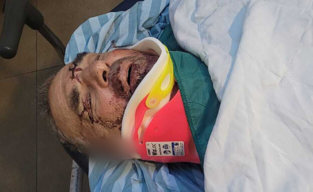 עודד ידעיה, נפצע באירוע אלימות במסיק בבורין 