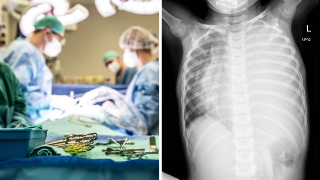 בת 4 עם גידול נדיר