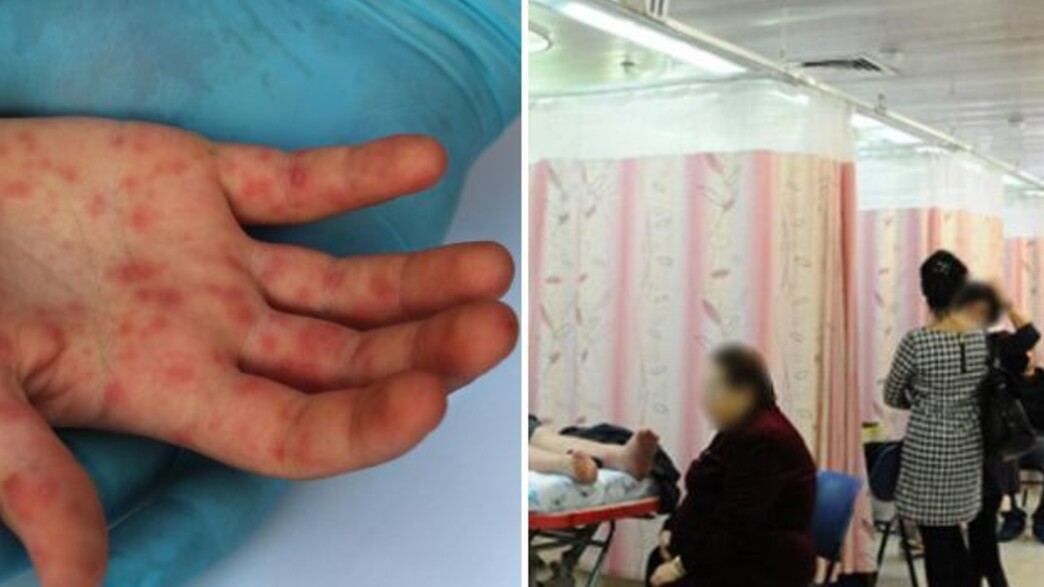 Measles patients were on the El Al flight