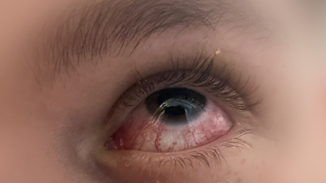 תקיפת נערים סמוך לסינמה סיטי