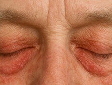 עבד בגינה בביתו - וכמעט התעוור: "סבל מכאב משתק"