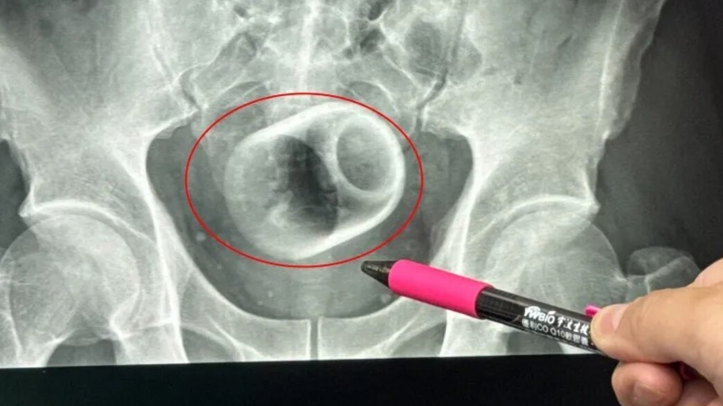 כוס התה שנמצאה בתוך הגבר