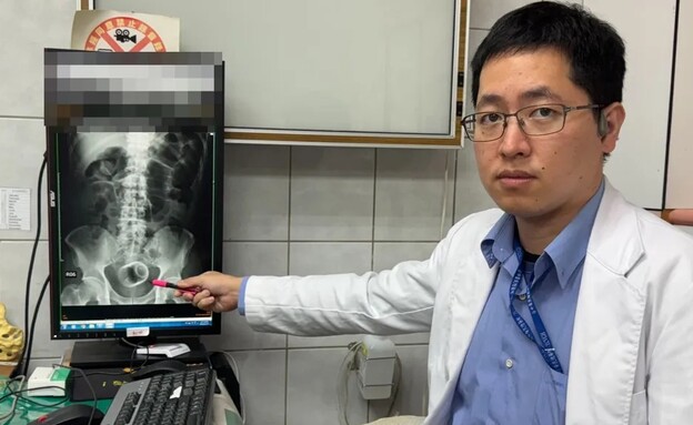 הרופא לצד כוס התה שנמצאה בתוך הגבר