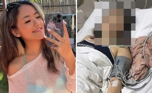 תיירת מתה בבאלי  (צילום: לפי סעיף 27א' לחוק זכויות יוצרים)