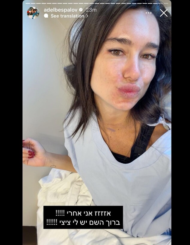 אדל בספלוב עשתה ניתוח להגדלת חזה אדל בספלוב עשתה ניתוח להגדלת חזה