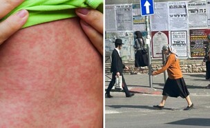 חצבת במאה שערים (צילום: יונתן דושניצקי|שאטרסטוק)