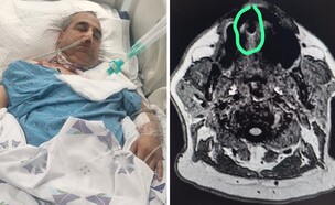 הניתוח המורכב (צילום: מרכז רפואי צפון)