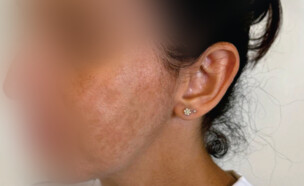 הטיפול הכושל