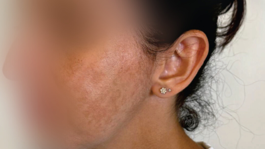 הטיפול הכושל