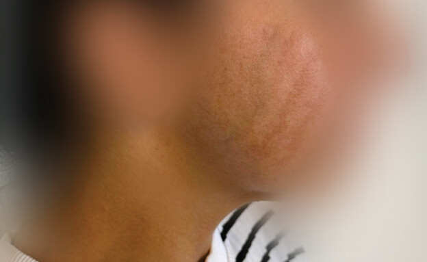 הטיפול הכושל