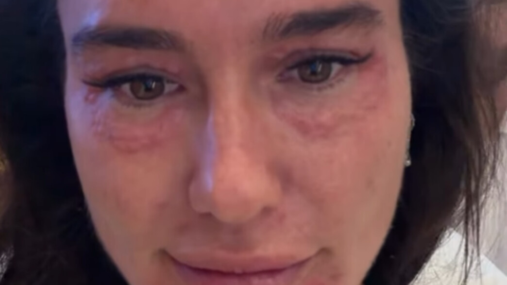 אדל בספלוב וזרעי הסלמון