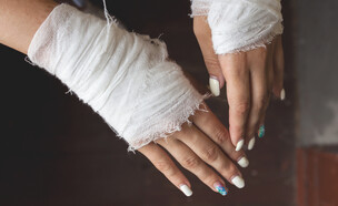 החתכים (צילום: שאטרסטוק)