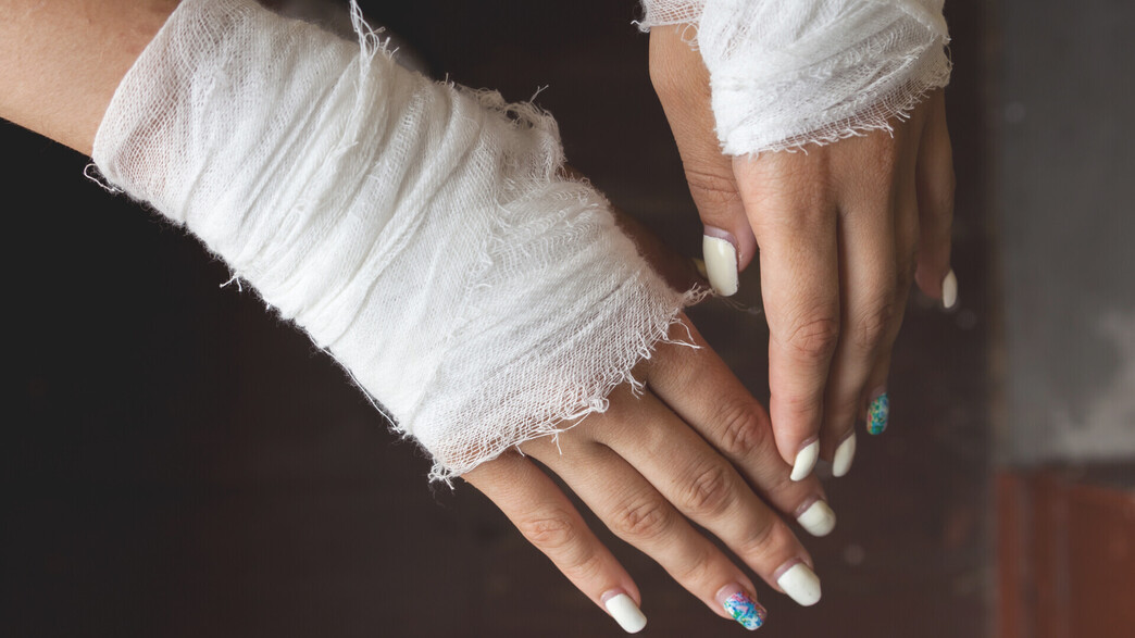 החתכים החתכים