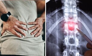 כאבי גב (צילום: shutterstock)