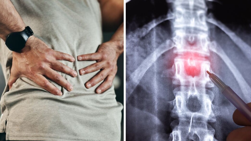 A noticeable increase in patient inquiries with worsening back and joint pain