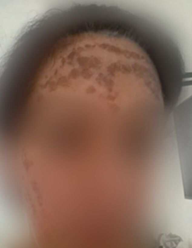 הטיפול הכושל