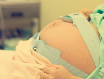 אישה בחדר לידה, אילוסטרציה.