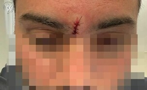 השוטר שנפגע מהגרזן באשדוד (צילום: דוברות המשטרה)