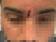 השוטר שנפגע מהגרזן באשדוד