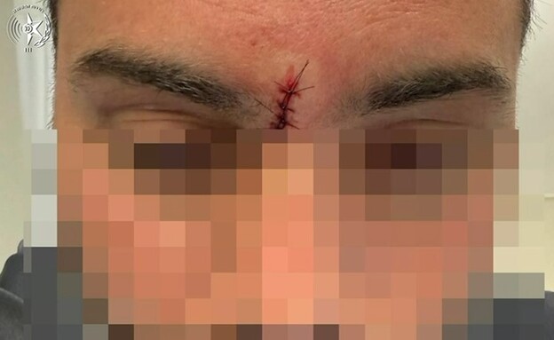 השוטר שנפגע מהגרזן באשדוד