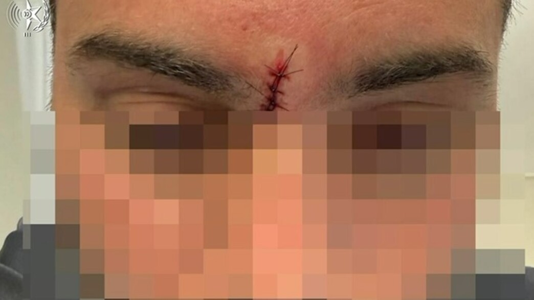 השוטר שנפגע מהגרזן באשדוד