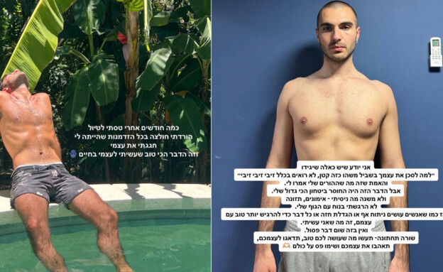 עידן כהן על הניתוח עידן כהן על הניתוח