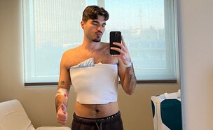 עידן כהן ניתוח (צילום: צילום פרטי, אינסטגרם)