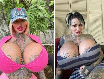 הסוף הטרגי של כוכבת הרשת שהתמכרה לניתוחים 