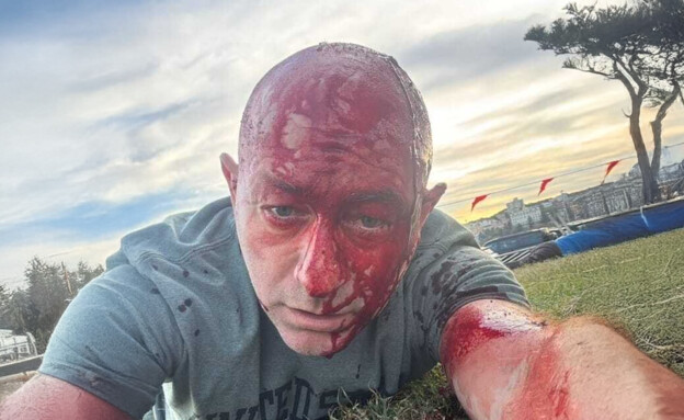 ארסן אוסטרובסקי, נפצע בפיגוע הירי בבונדי ביץ' ארסן אוסטרובסקי, נפצע בפיגוע הירי בבונדי ביץ'