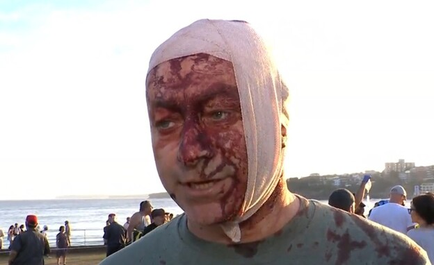 ארסן אוסטרובסקי, נפצע בפיגוע הירי בבונדי ביץ' ארסן אוסטרובסקי, נפצע בפיגוע הירי בבונדי ביץ'