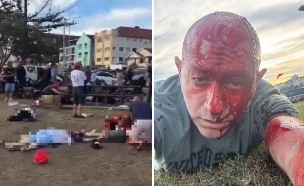 פצועים והרוגים סידני אוסטרליה (צילום: לפי סעיף 27א' לחוק זכויות יוצרים)