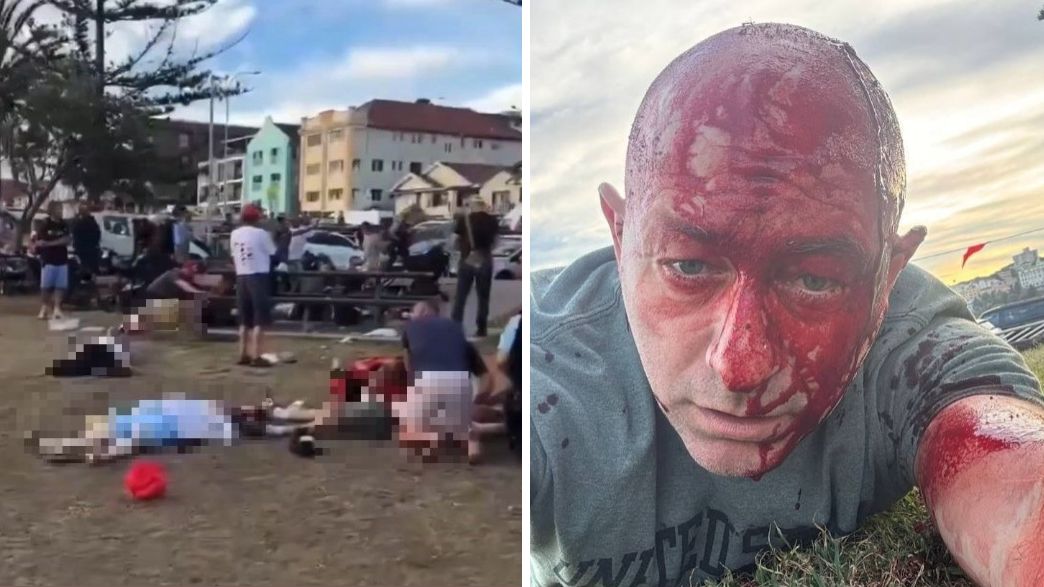 פצועים והרוגים סידני אוסטרליה פצועים והרוגים סידני אוסטרליה