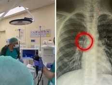 "לא ראינו דבר כזה כבר שנים״: 3 מקרים חריגים בצפון