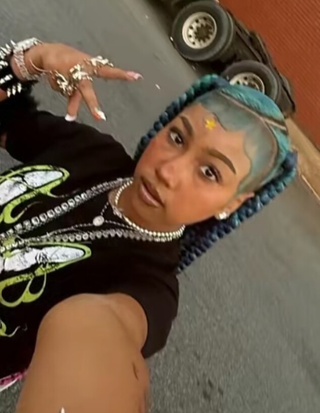 נורת' ווסט מחוררת את הפנים