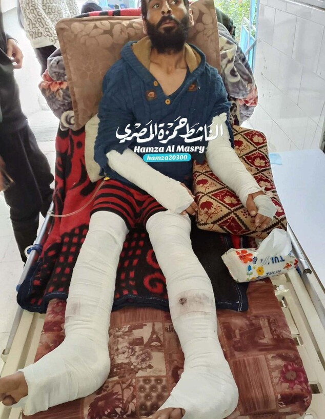 מוחמד אל-מג'אידה אחרי שעבר עינויים בידי מחבלי חמאס מוחמד אל-מג'אידה אחרי שעבר עינויים בידי מחבלי חמאס