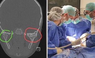 הניתוח הנדיר ברמב"ם (צילום: רמב"ם)