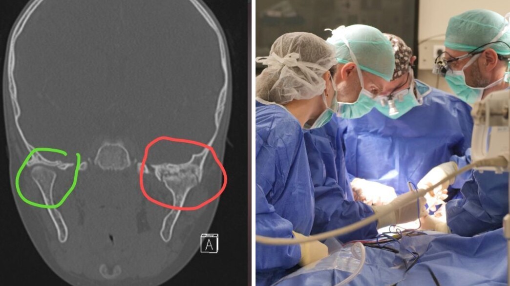 הניתוח הנדיר ברמב"ם